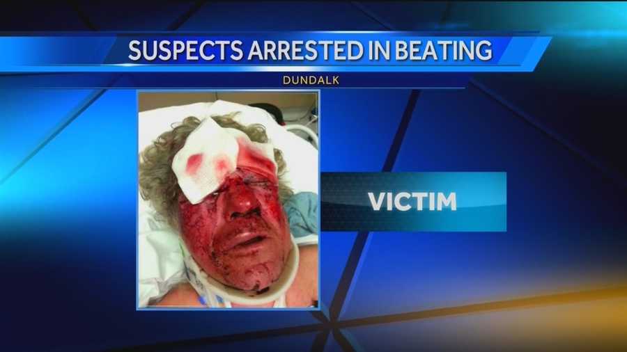 baltimore beaten nearly death black students from local high school baltimore beaten nearly death black students from local high school