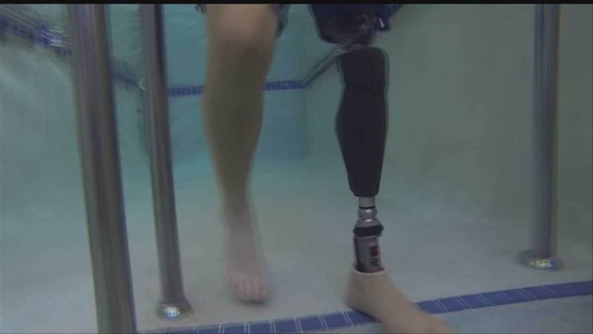 Neb. amputee gets hightech, waterproof prosthetic leg