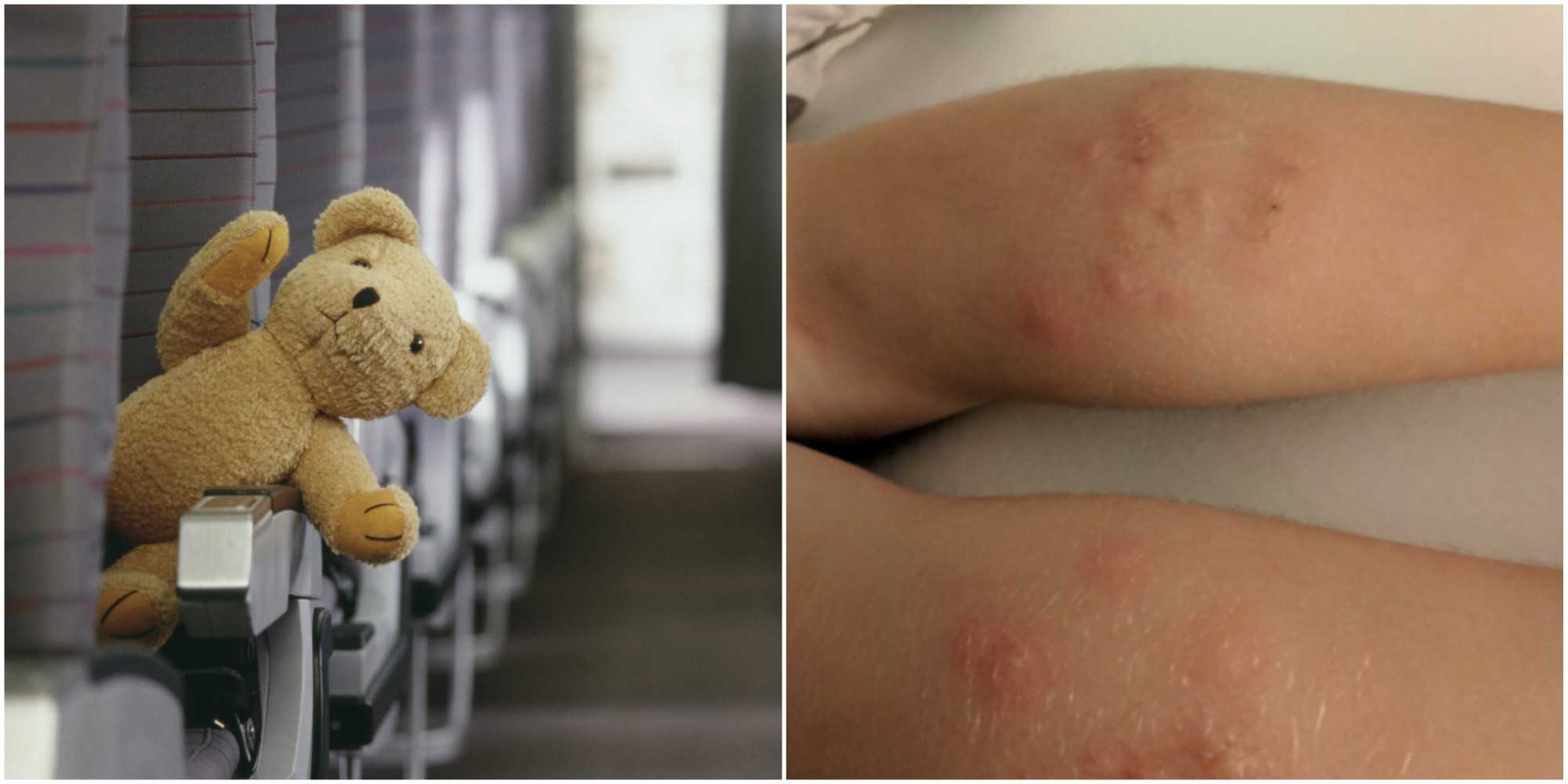 How to tell if there are bed bugs on your airplane seat