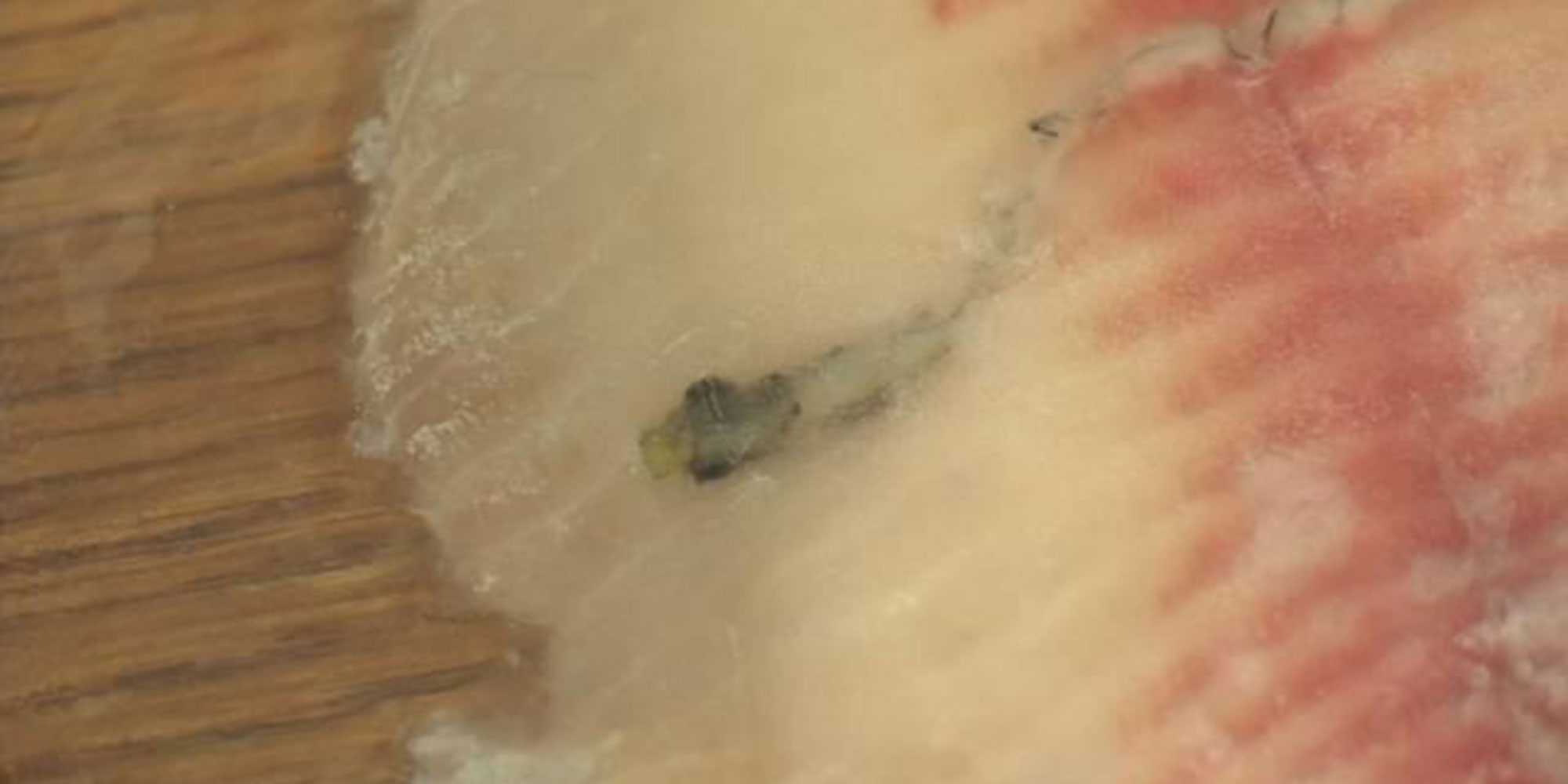 Mother finds a worm frozen inside a piece of Walmart fish