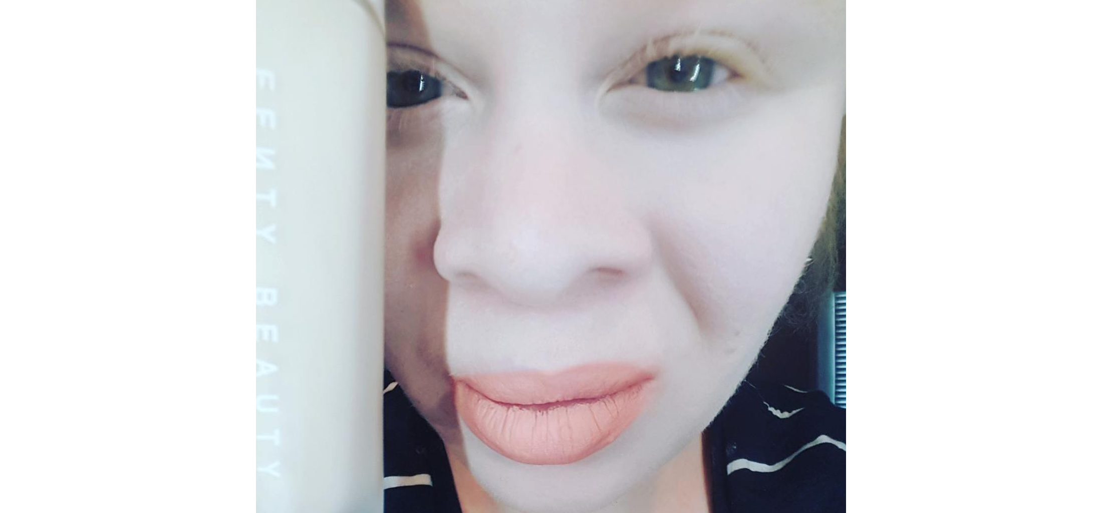 Rihanna's new makeup line is getting praise from people with albinism