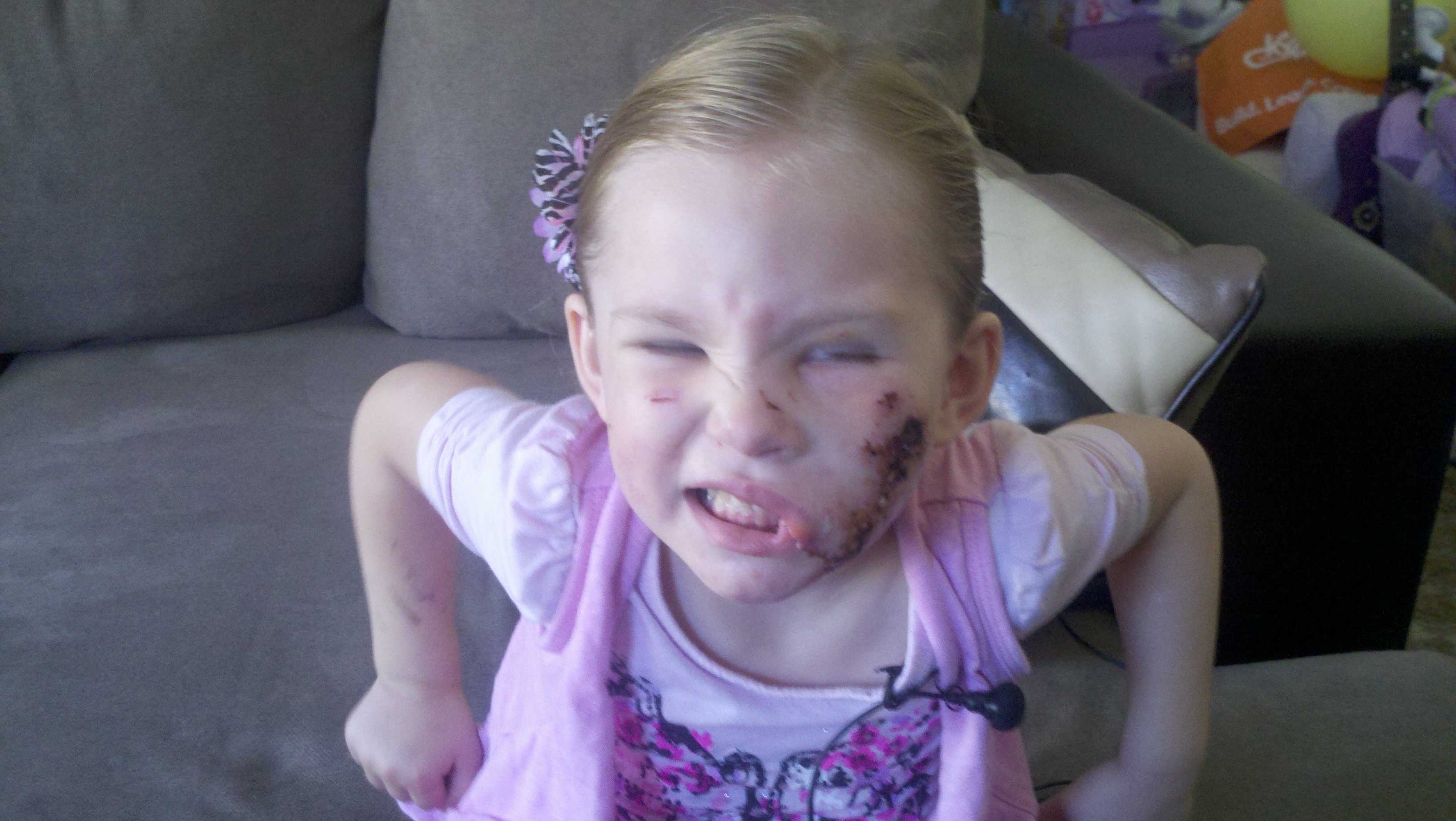 Photos: Girl Recovers From Pit Bull Attack