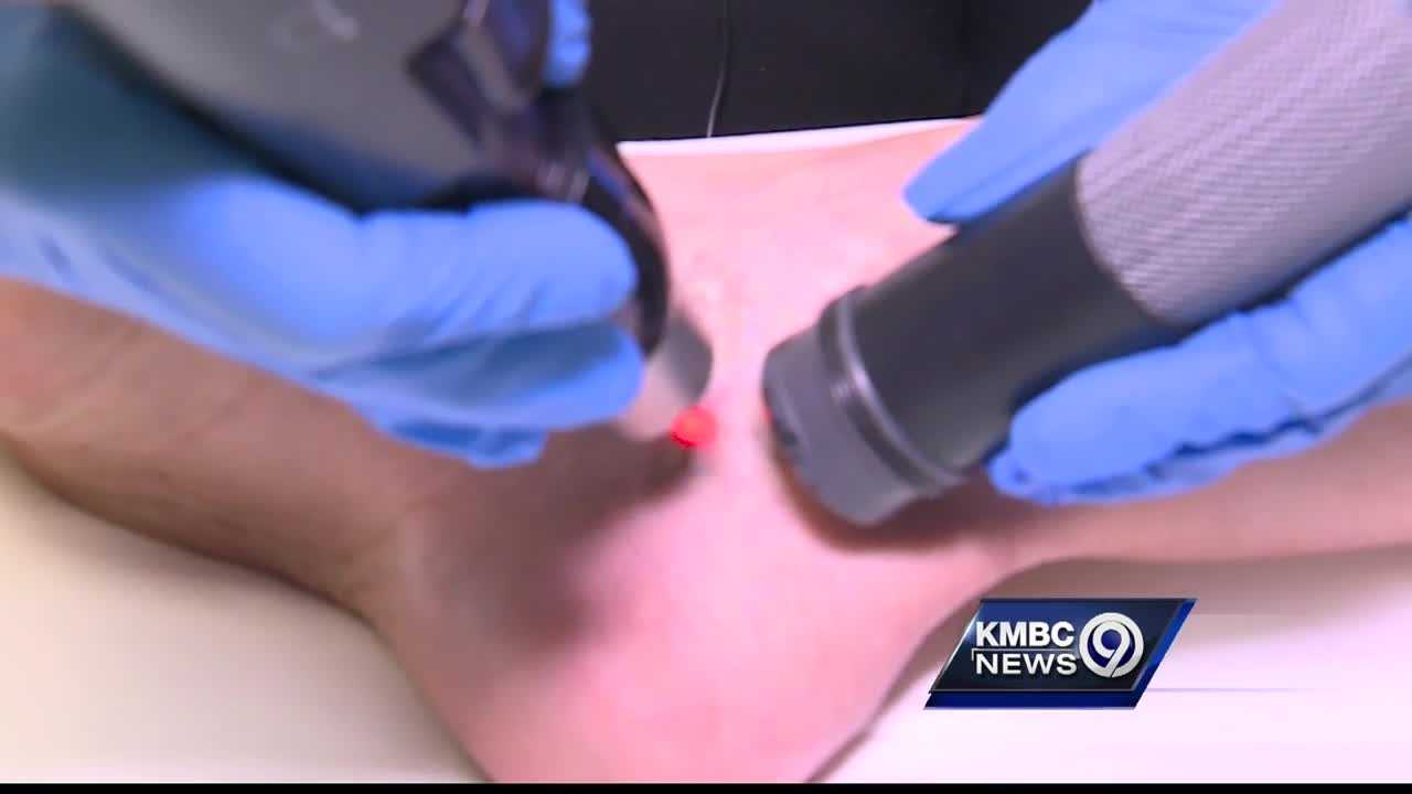 new tattoo removal technology makes work faster less painful new tattoo removal technology makes work faster less painful