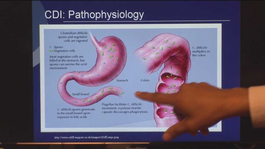 Fecal transplant helps patients of painful C.diff