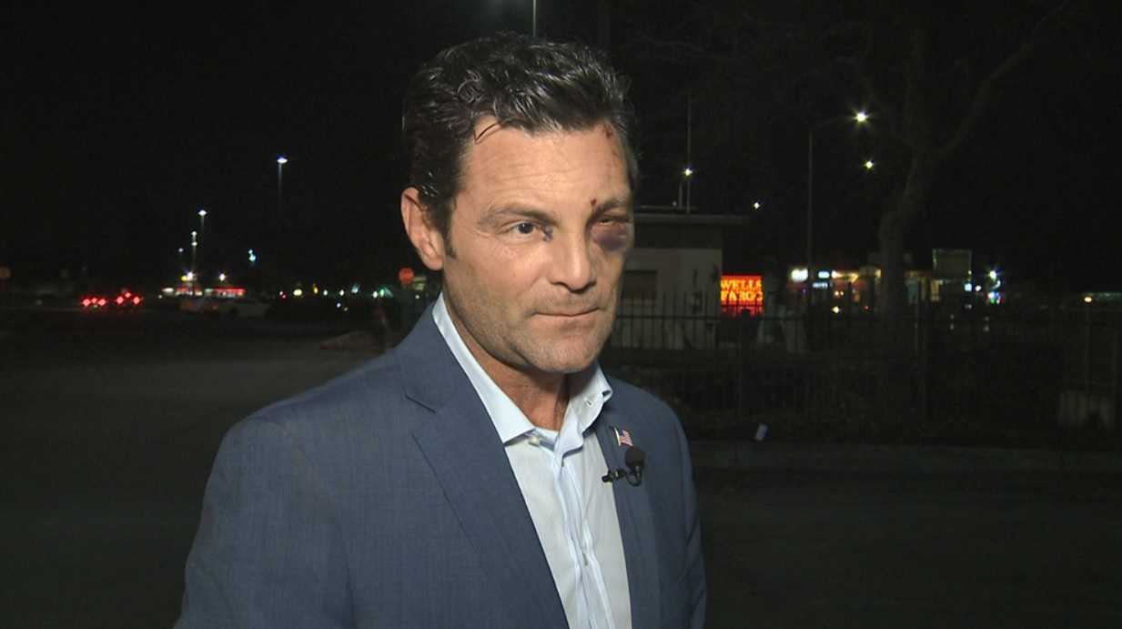 San Joaquin County supervisor beaten while trying to protect assault victim