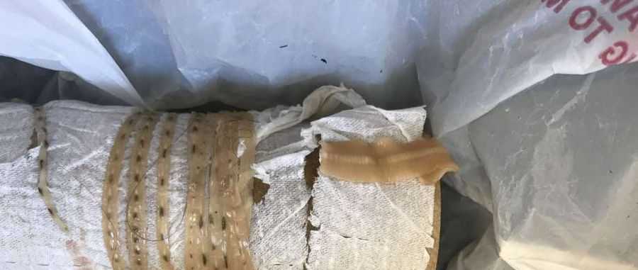Sushi Lover Pulled A 5 Foot Tapeworm From Intestine California Doctor Says