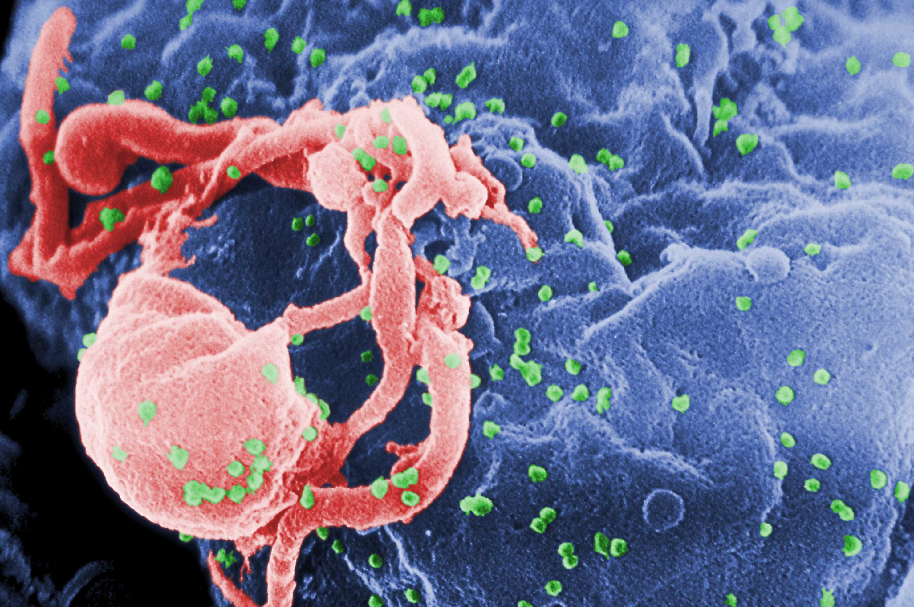 CDC: Person with undetectable HIV 'effectively no risk' of transmitting virus