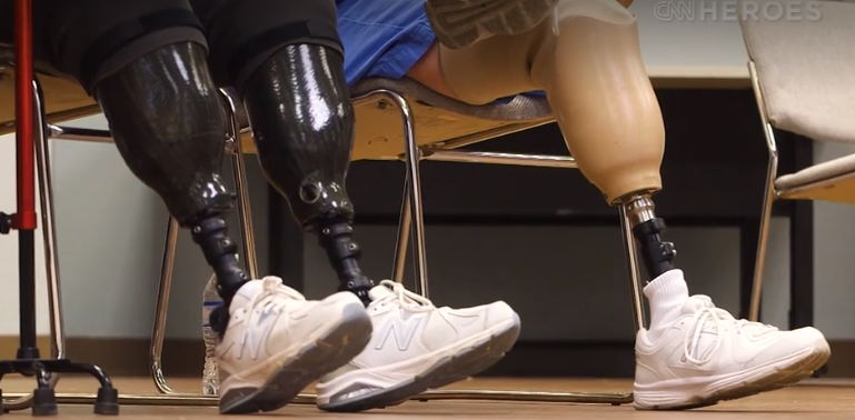 Woman uses personal tragedy to help other amputees