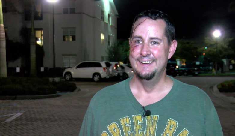 Bear attacks Packers fan in southwest Florida Bear attacks Packers fan in southwest Florida