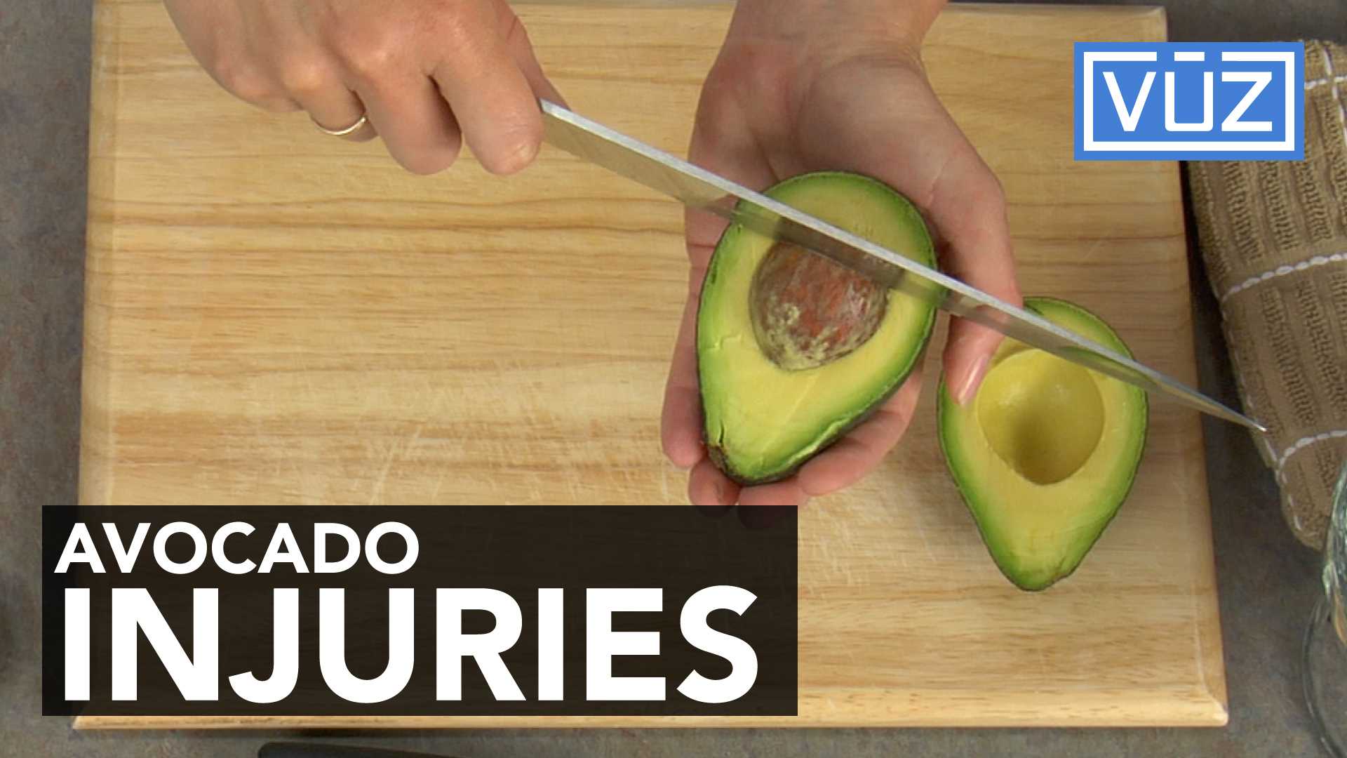 'Avocado hand' is sending people to the hospital