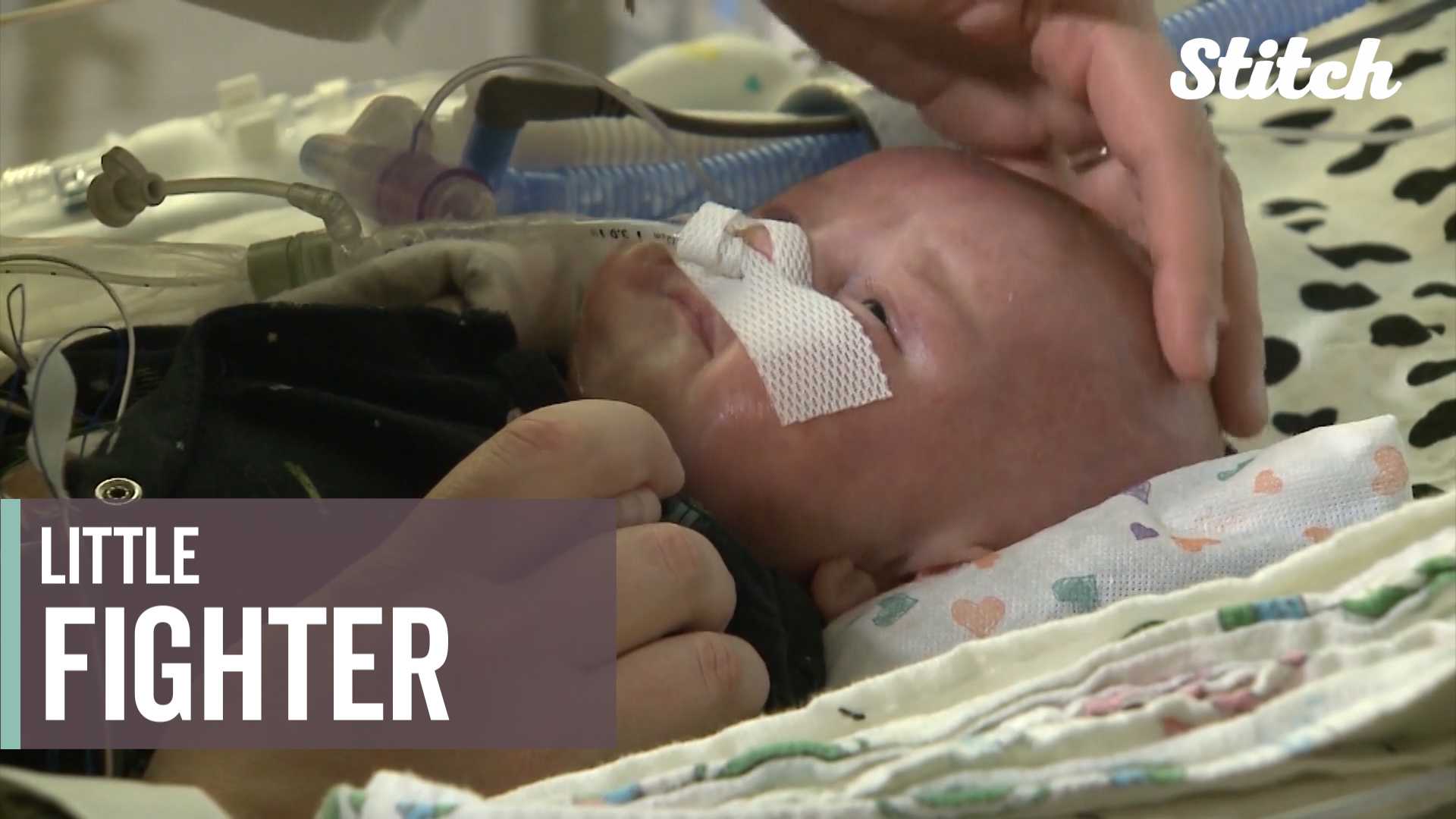 Little fighter: 4-month-old boy survives two open-heart surgeries