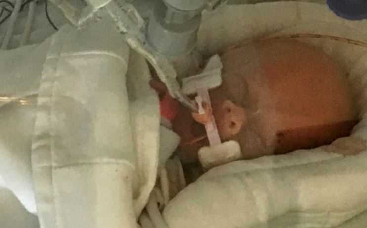 Baby whose mother chose giving birth over chemo has died