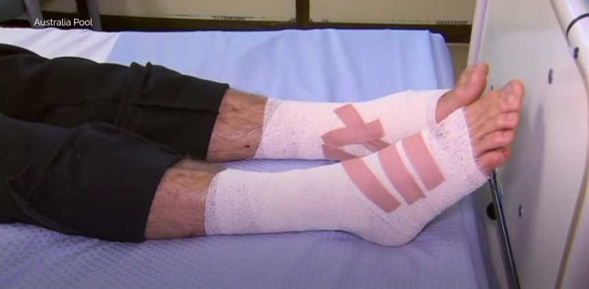 Teen’s feet left bloodied by strange sea creatures