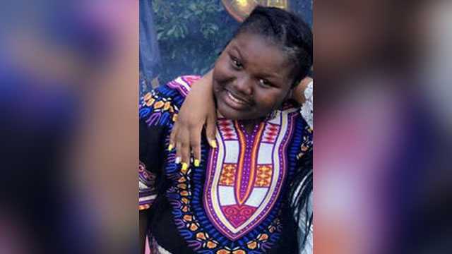 Boiling water dumped on 11-year-old girl's face during sleepover