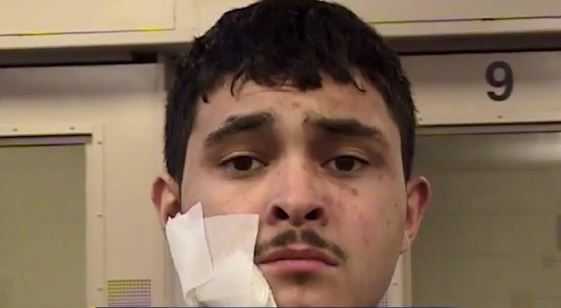 Homeowners beat up, detain would-be burglar