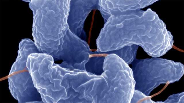 Pet store puppies spread antibiotic-resistant infection, CDC says