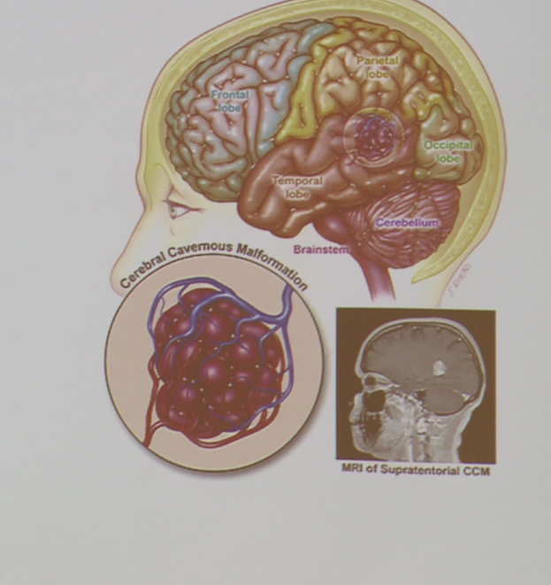 An organization helps people learn more about a rare disease