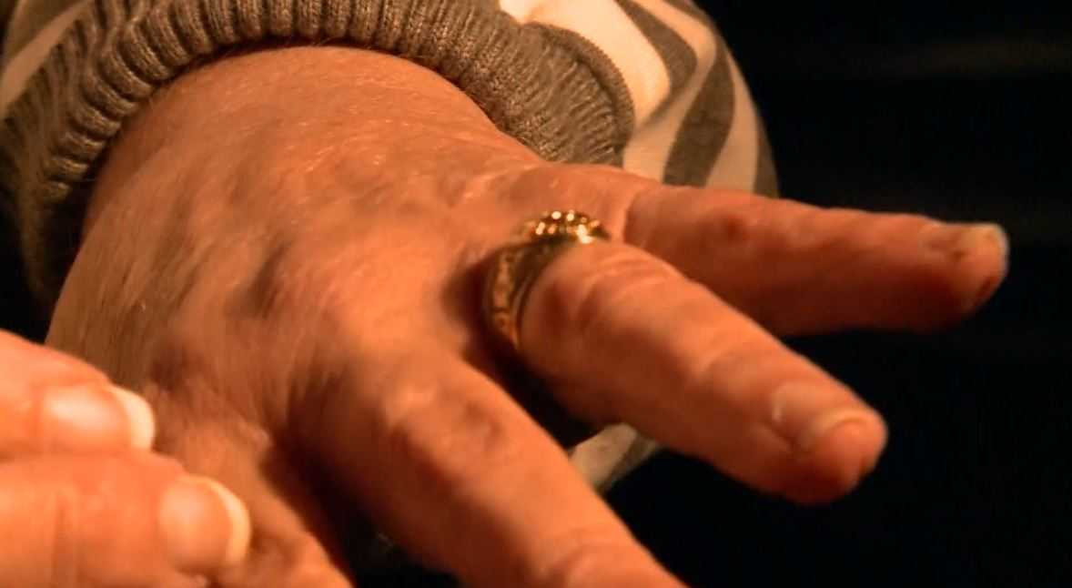 'And it still fits!' Woman reunited with lost ring after 35 years