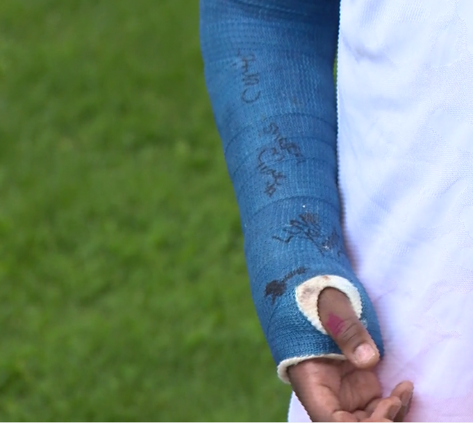 School therapist charged with assault after student's elbow is broken