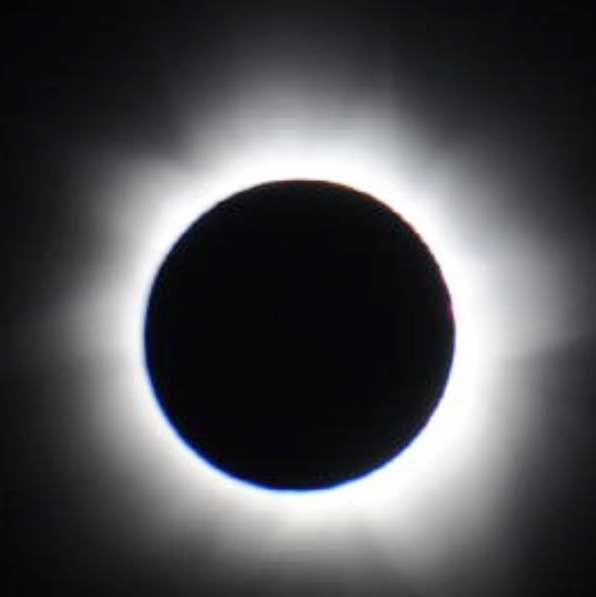 Doctor explains why staring at eclipse can cause permanent eye damage