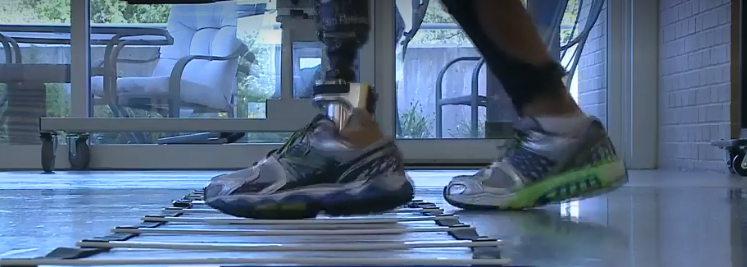 Anything is possible: Amputee prepares to run first 5K