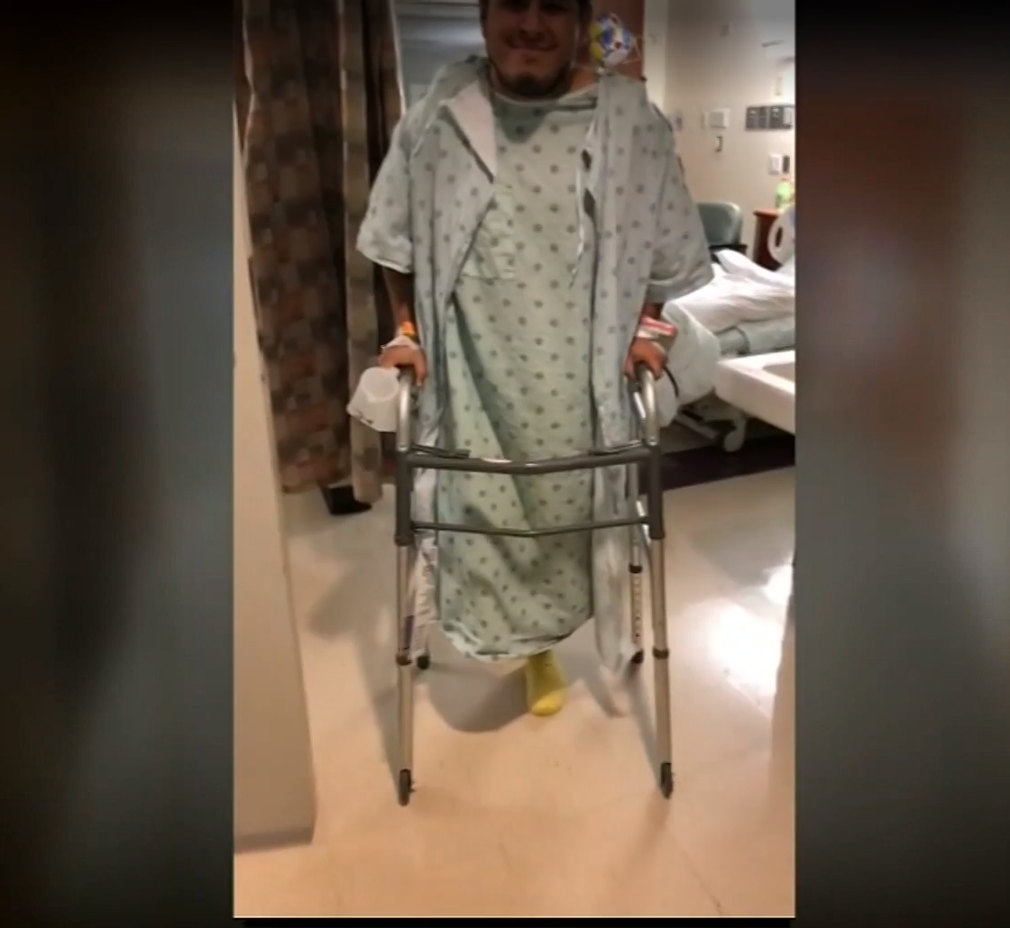 Daycare teacher loses foot to flesh-eating bacteria