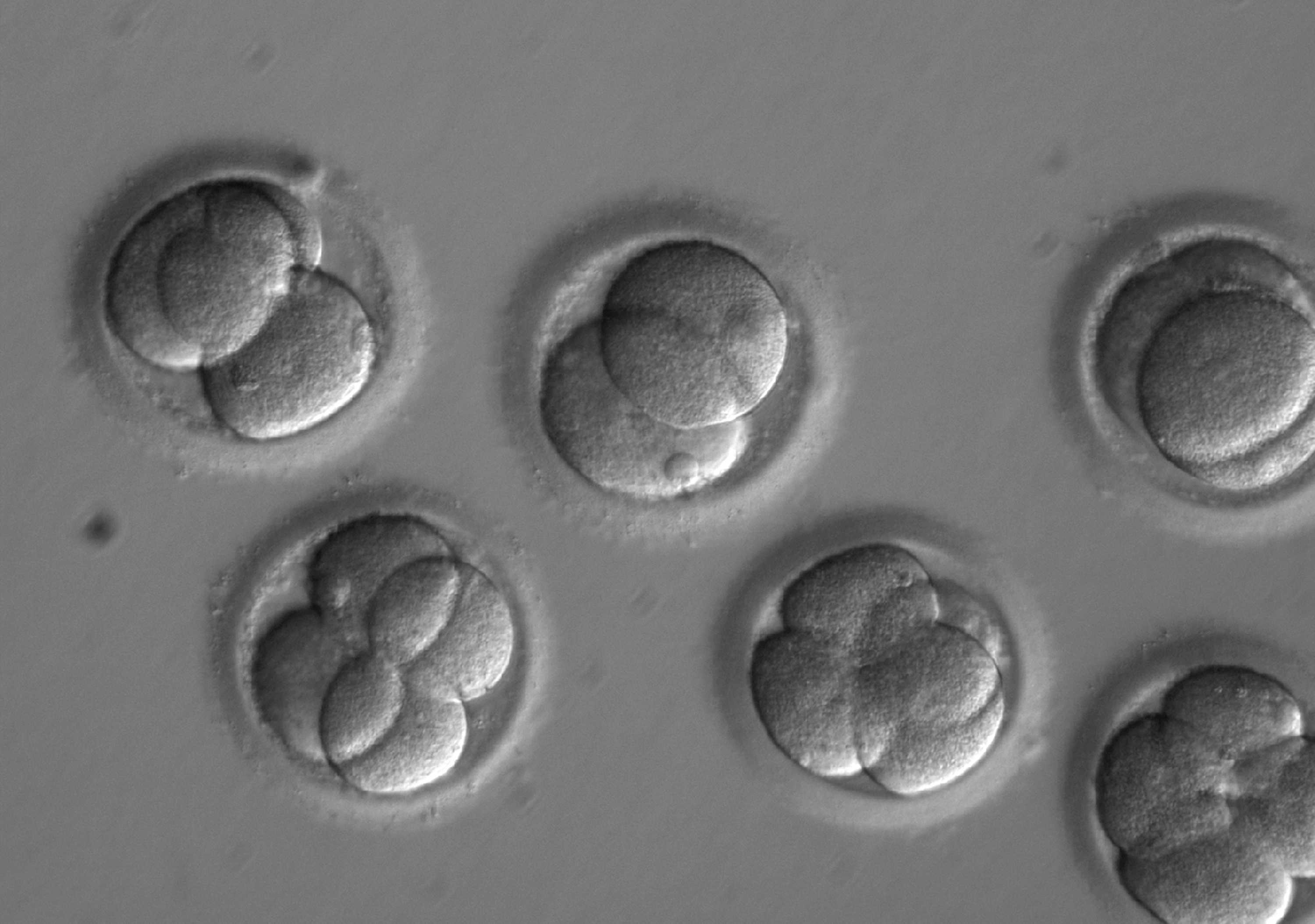 First safe repair of disease-causing gene in human embryos 'definitely a leap forward'