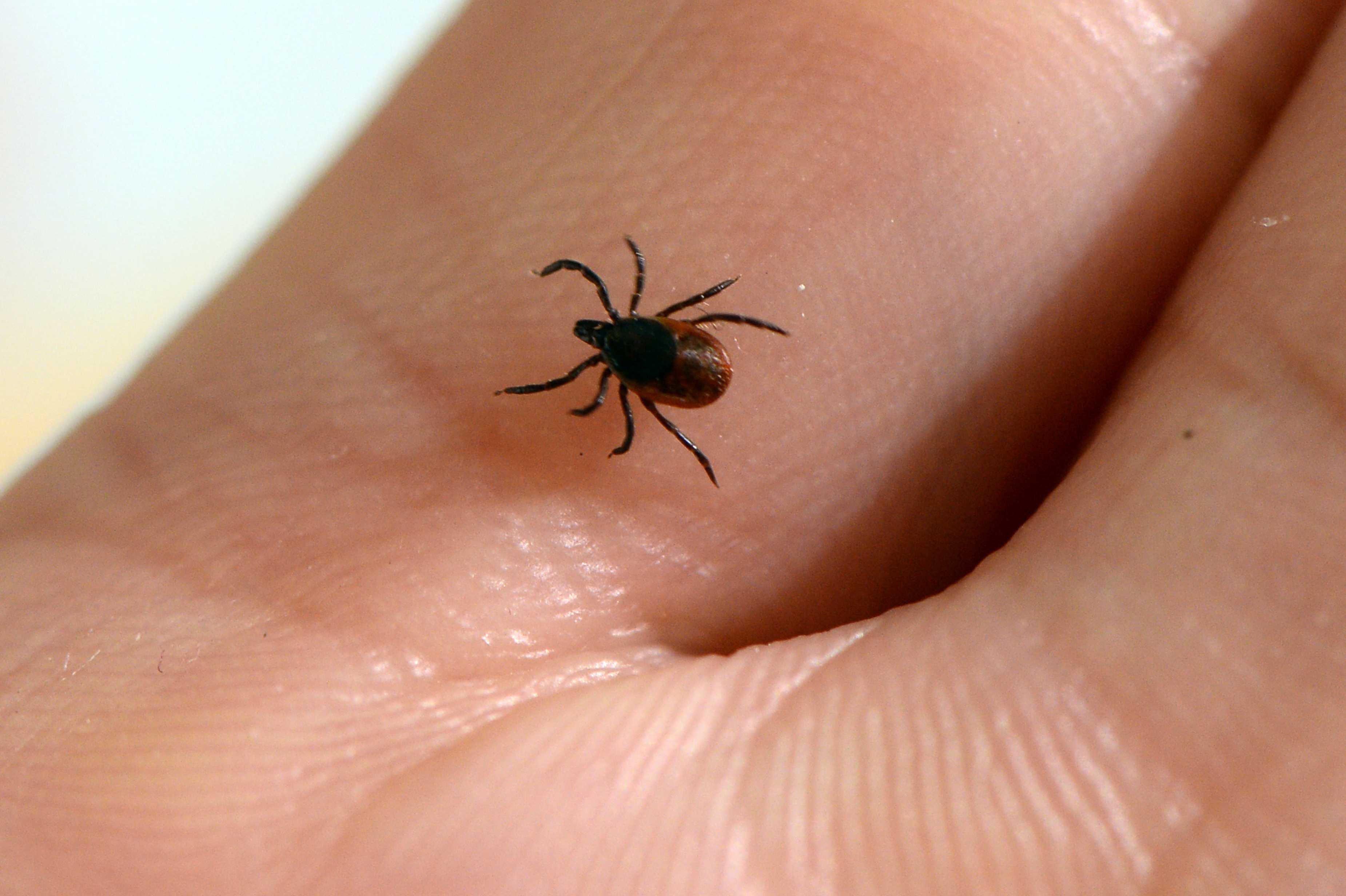Teen battling Lyme disease develops app for tracking ticks