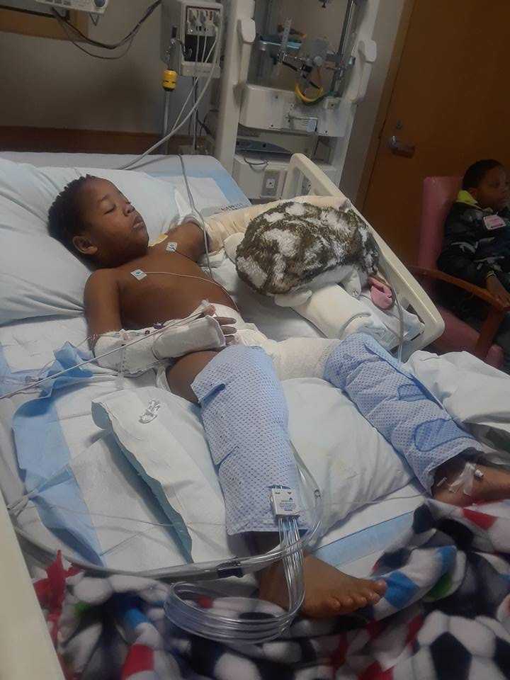 5-year-old boy hospitalized after being attacked by neighbor's dog