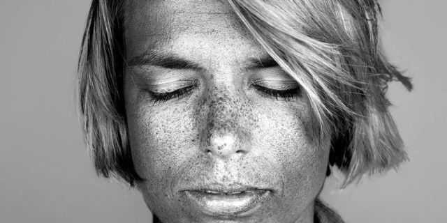 These incredible photos show just what the sun does to your skin