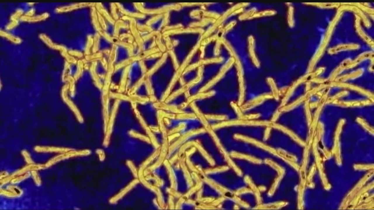 2 Las Vegas hotel guests contract Legionnaires' disease