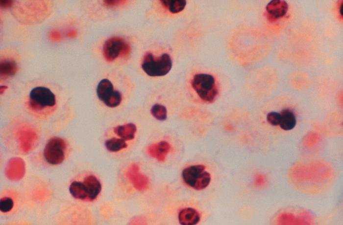 2 guests contract Legionnaires' disease at Las Vegas hotel