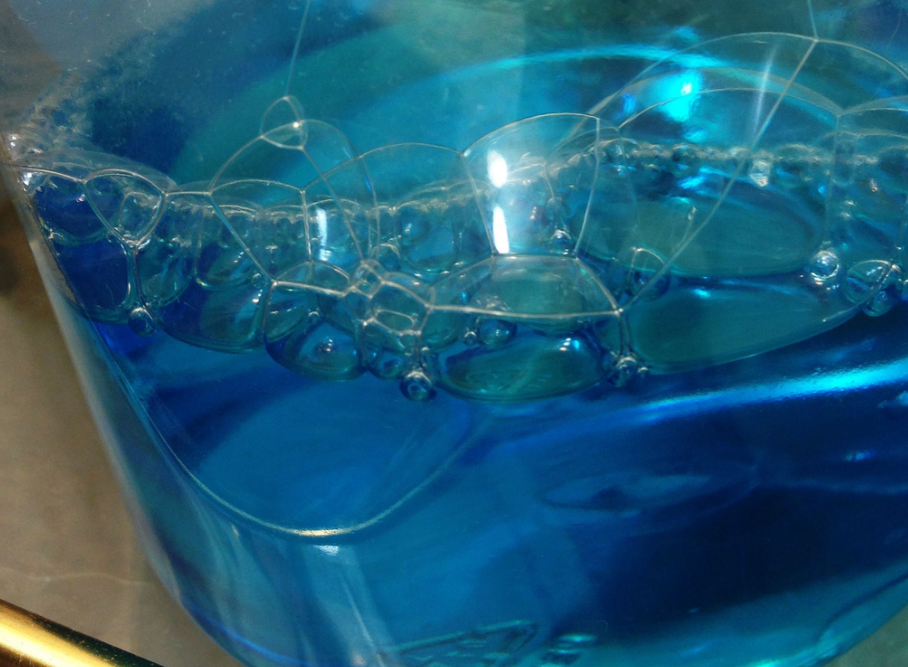 Regular mouthwash use linked to higher risk of diabetes