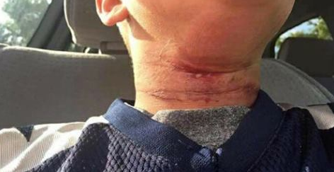 Family: Boy taunted with racial slurs, pushed off table with rope around neck