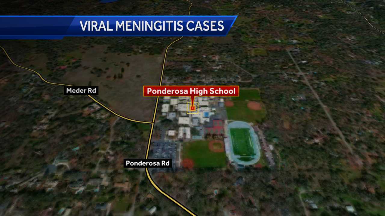 3 cases of viral meningitis confirmed at Ponderosa High School