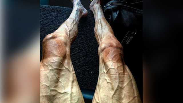 This is what legs look like after 16 stages on the Tour de France