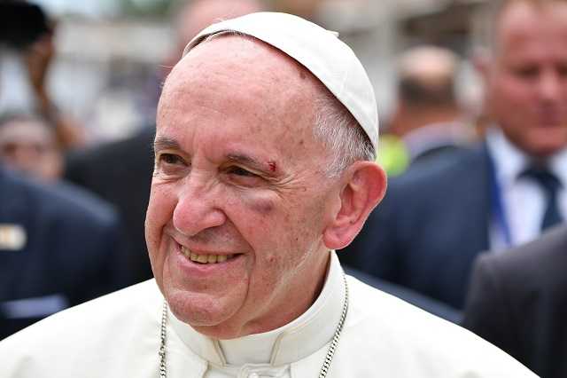 Pope Francis doesn't let black eye cloud Colombia visit