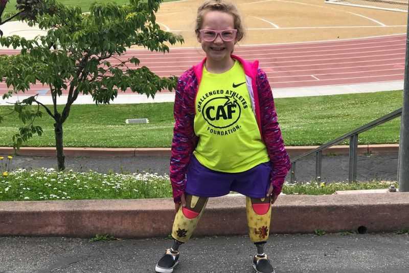 9-year-old given new legs after wildfires claim prosthetics