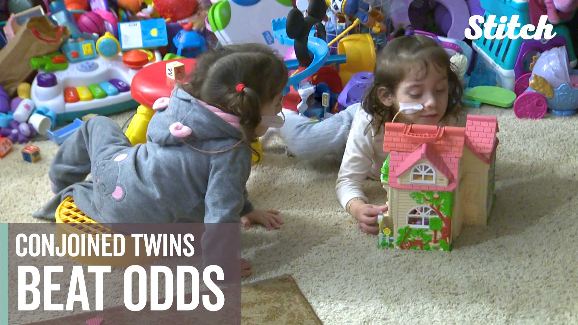 Separated conjoined twins overcome the odds