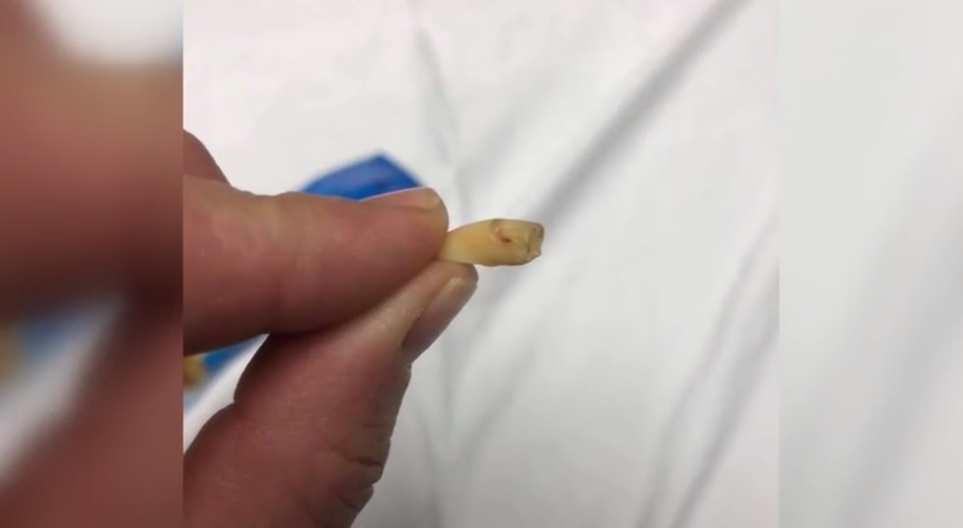 Woman says she found bloody human tooth while eating cashews