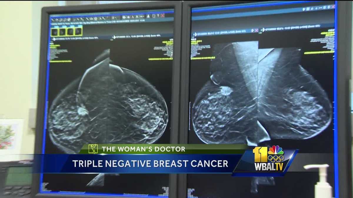 Woman's Doctor: Triple negative breast cancer more rare form of cancer