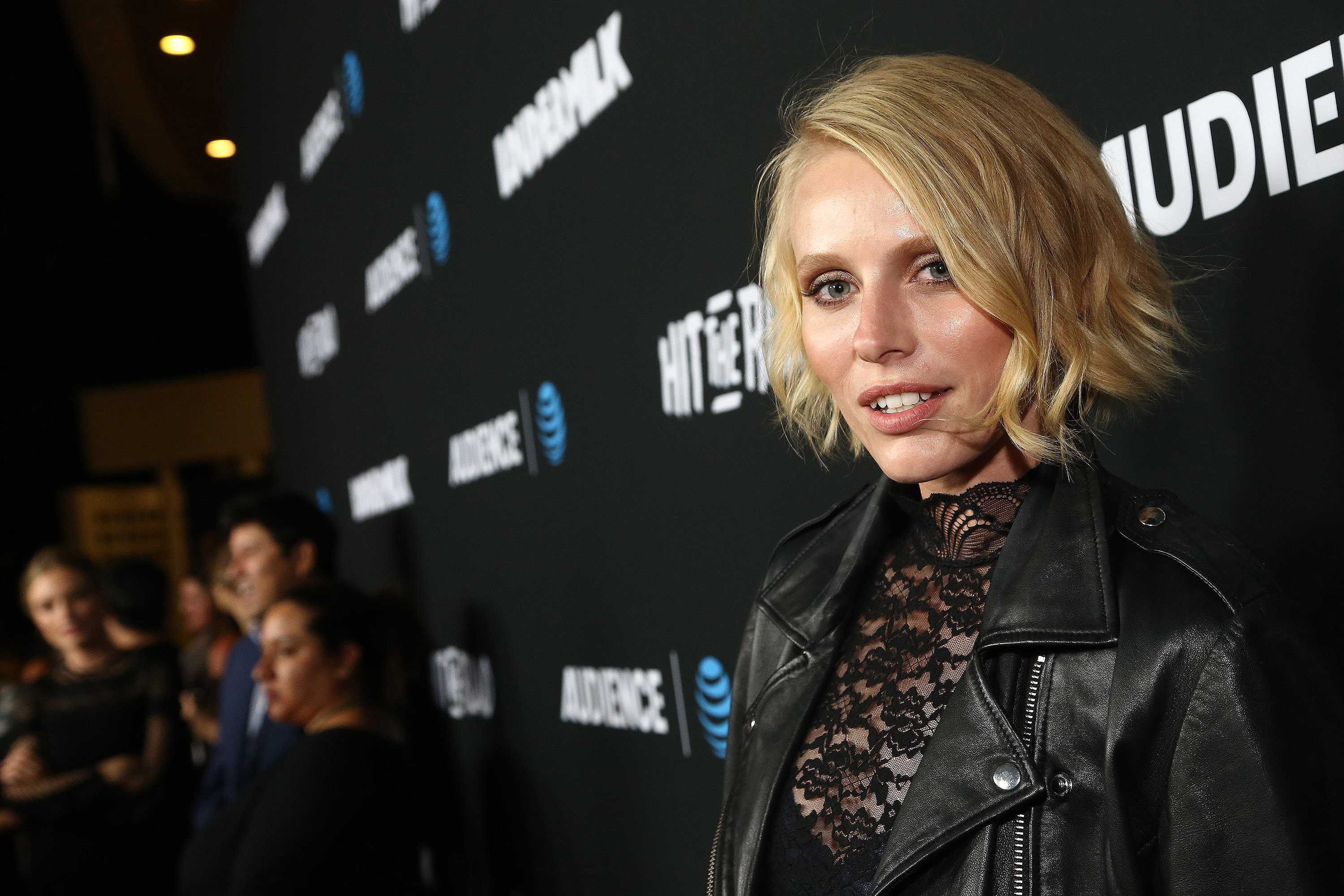 Model facing second leg amputation warns of toxic shock syndrome