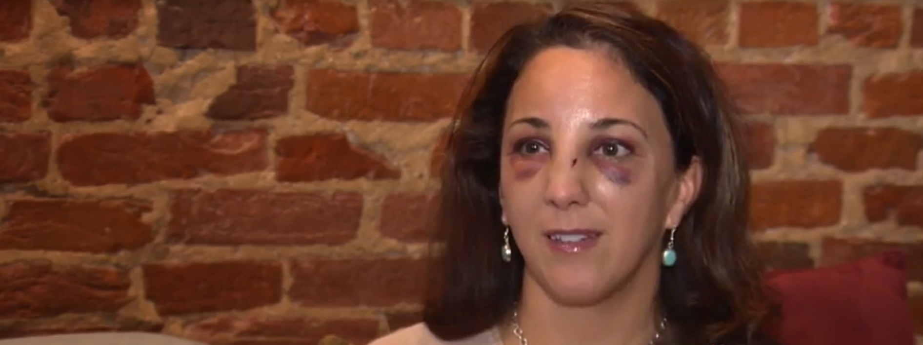 'I feel lucky to be alive': Woman jumped, savagely beaten by 10 teens in Baltimore