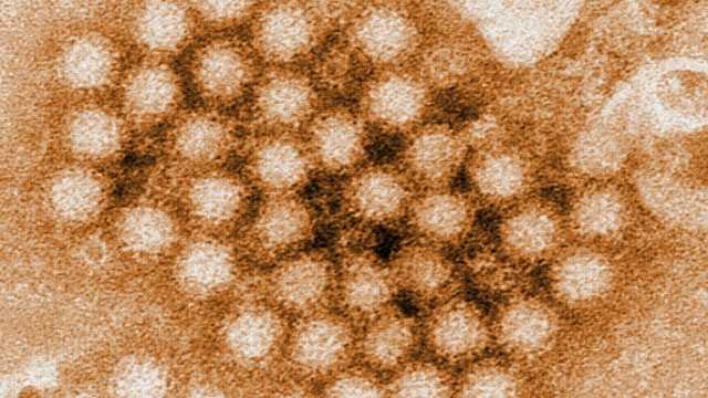 Norovirus symptoms reported at 30 Sacramento schools