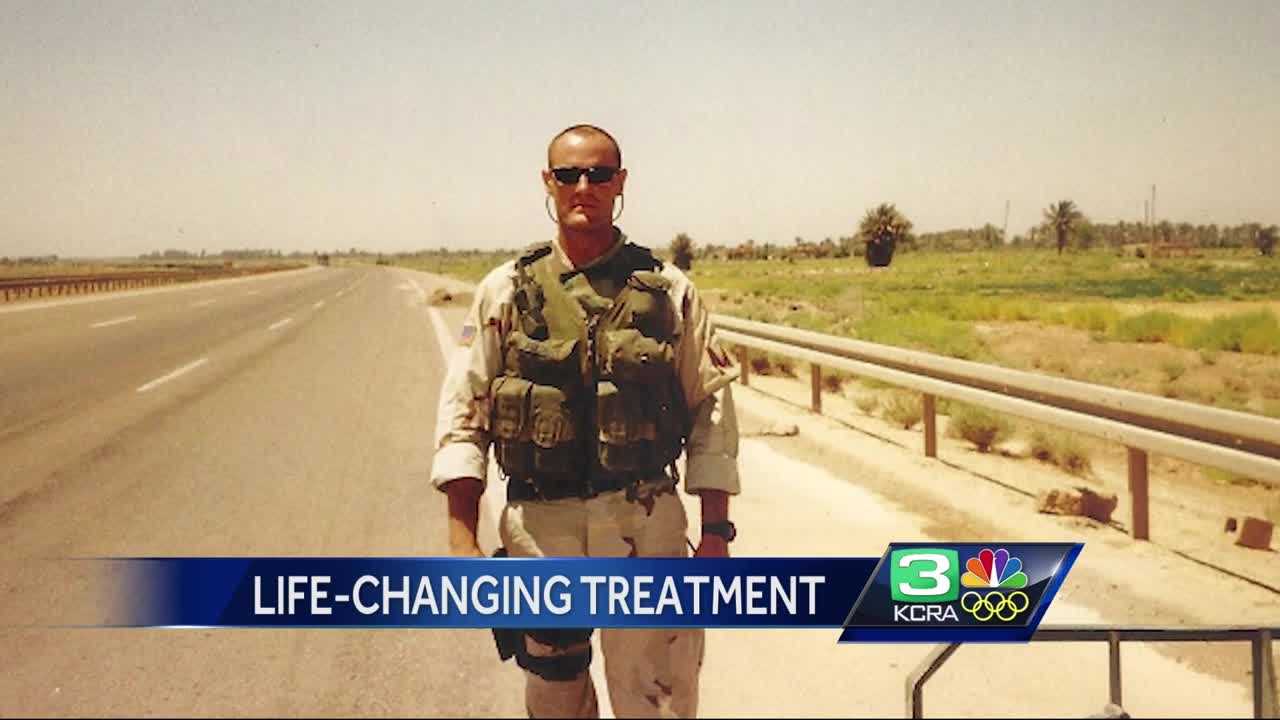 Granite Bay man raises money for life-changing drug for PTSI victims