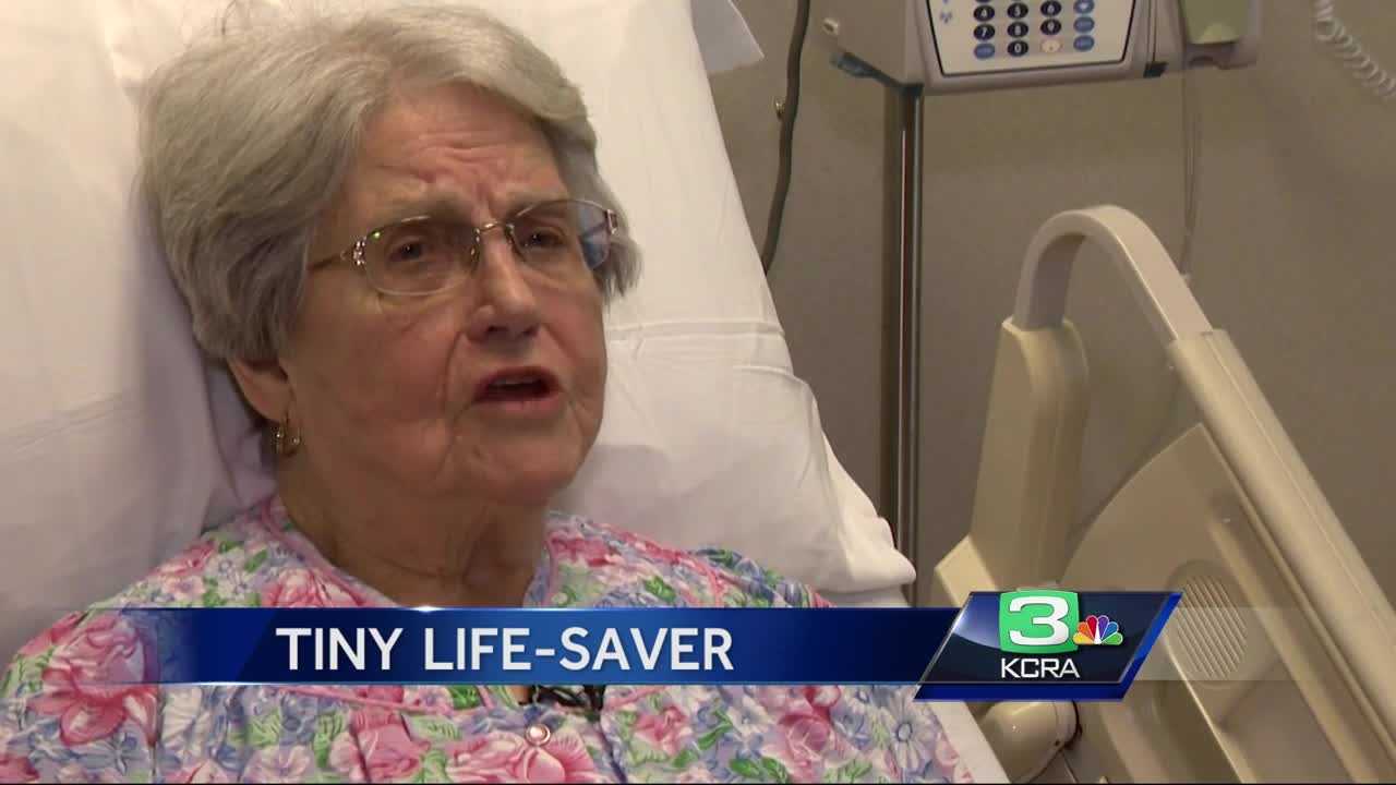 World's smallest pacemaker helps Sacramento woman live