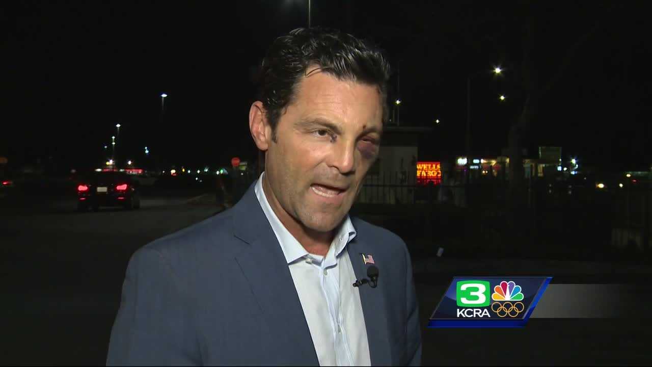 County supervisor fights off man attacking woman in Stockton
