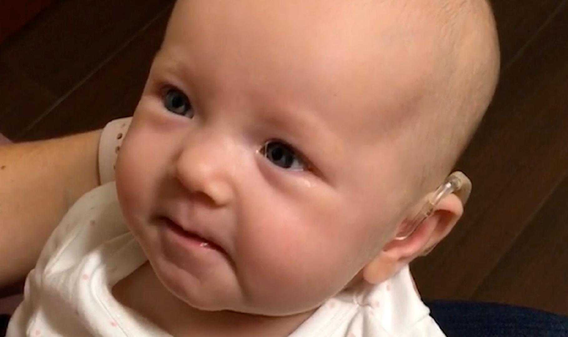 Baby's face when hearing for first time will melt your heart