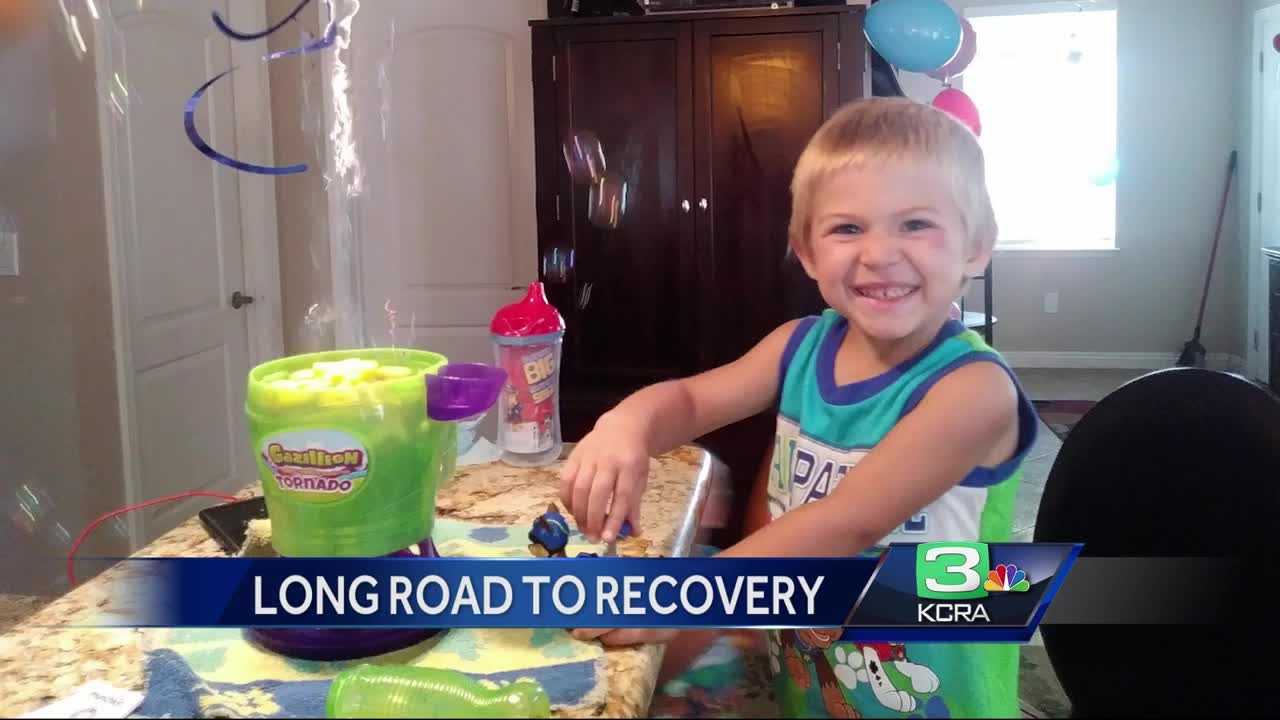 3-year-old faces long recovery after head-on crash