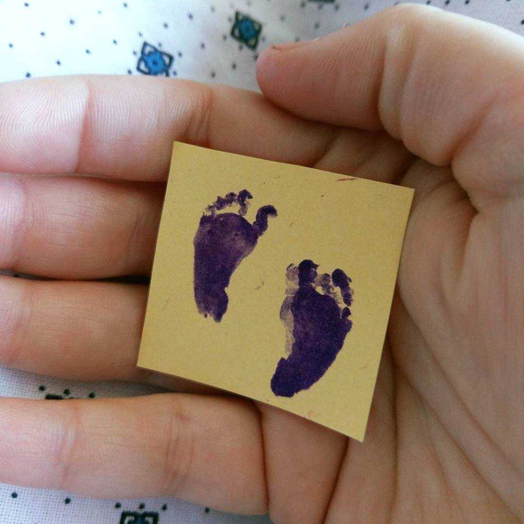 Five months into pregnancy, mother loses baby boy